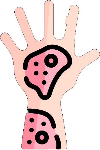 Burn Diagnosis AI Challenge